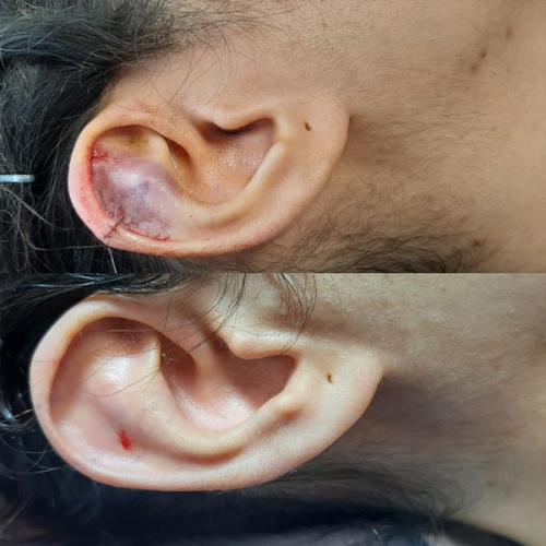 جراحی-گوش-در-تهران11