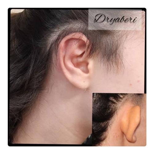 جراحی-گوش-در-تهران15