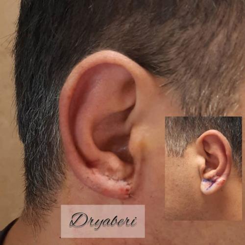 جراحی-گوش-در-تهران18