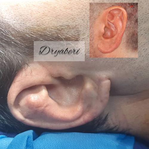 جراحی-گوش-در-تهران19