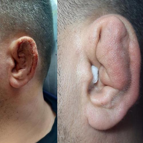 جراحی-گوش-در-تهران2