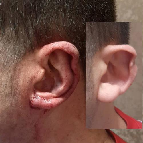 جراحی-گوش-در-تهران20