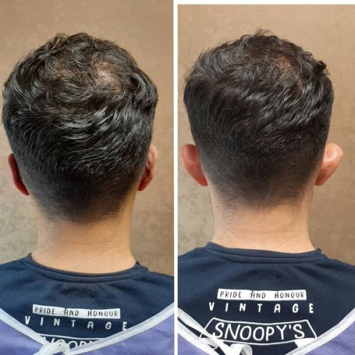 جراحی-گوش-در-تهران21