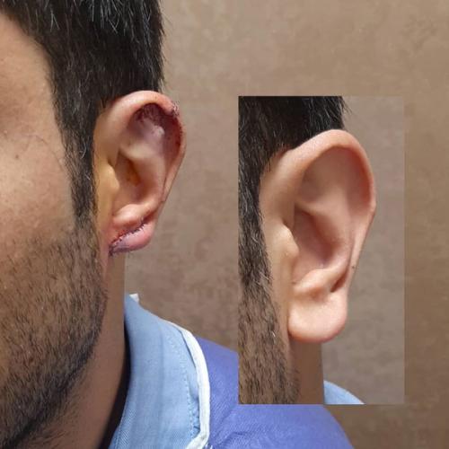 جراحی-گوش-در-تهران22