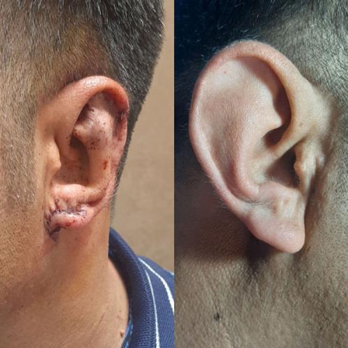 جراحی-گوش-در-تهران24