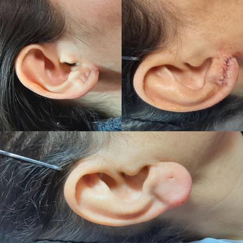 جراحی-گوش-در-تهران3