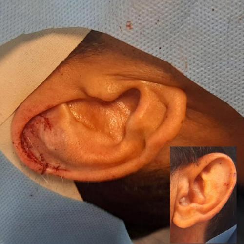 جراحی-گوش-در-تهران31