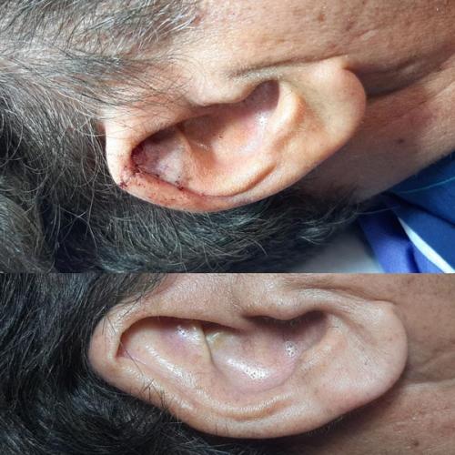 جراحی-گوش-در-تهران33