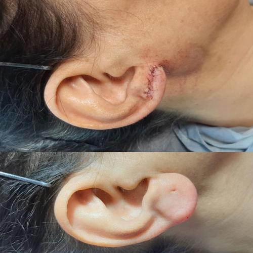 جراحی-گوش-در-تهران4