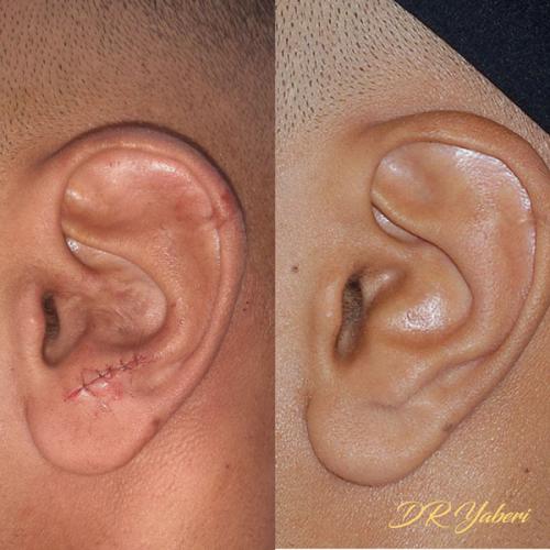 جراحی-گوش-در-تهران41