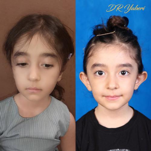 جراحی-گوش-در-تهران44