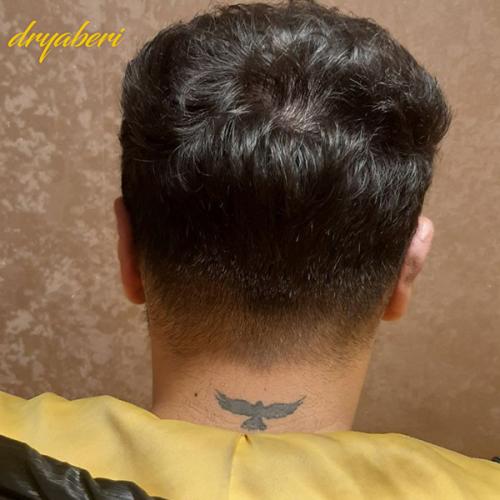 جراحی-گوش-در-تهران60