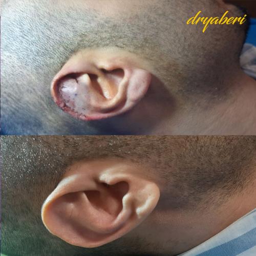 جراحی-گوش-در-تهران61