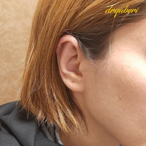 جراحی-گوش-در-تهران63