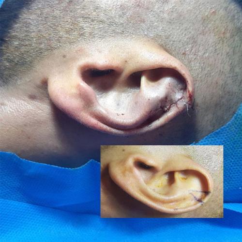 جراحی-گوش-در-تهران7