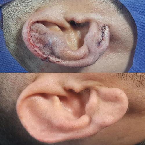 جراحی-گوش-در-تهران9